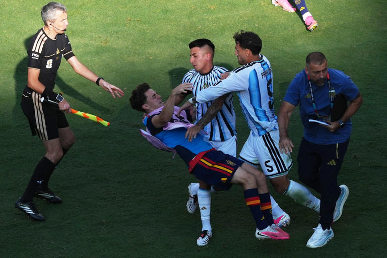 Argentina descubre que perder también es parte del fútbol